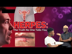 HERPES: The Truth No One Tells You | Causes, Myths, Treatments & Real Facts Dr. Adetolu Warns
