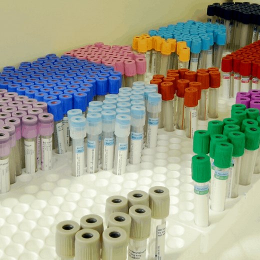 Order of Draw for Phlebotomy & Study Guide – PhlebotomyU