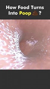 3.2K views · 12 reactions | How Food Turns Into Poop? | Working Of Human Digestive System (3D Animation) #fooddigestion #digestion #digestionoffood #humandigestivesystem #digestivesystem #digestivesystemhealth #digestive #stomach #pancreas #smallintestine #largeintestine #waterabsorption #medical3d #medical3danimation #poop #foodintopoop | Mix Dancing Events | Facebook