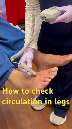 How to check arterial circulation by Doppler