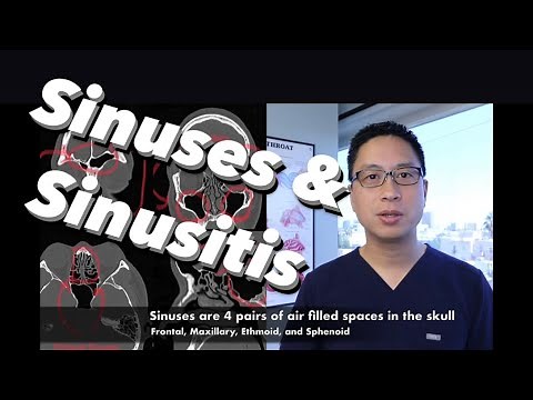 Sinuses, Sinusitis, Sinus Surgery Overview - what are sinuses, what do they do, how do we treat them
