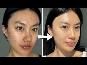 how I cleared my skin in a week with $0