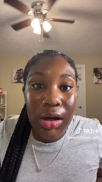 Understanding Bell's Palsy: Causes and Insights