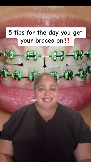 5 Tips for Getting Braces: Your Essential Guide