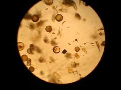 Plankton Under A Microscope