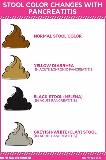 9 Common Stool Changes with Pancreatitis (With color illustrations). - Oh My Gut