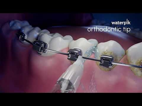 Waterpik™ Orthodontic Tip