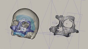 What is Topology Optimization? | Autodesk