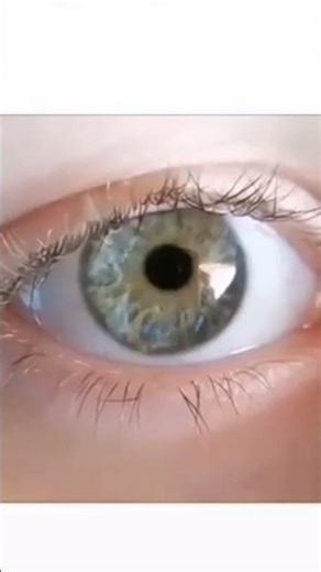 Nystagmus Explained | Causes, Diagnosis & Treatment in Simple Words |High Yield Neurology #nystagmus