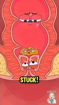 The Science of Prolapse 💩 #shorts #science