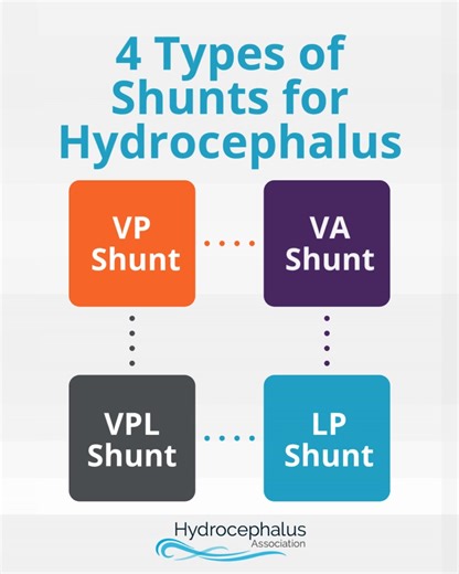 15K views · 183 reactions | Shunt systems manage #hydrocephalus by redirecting excess cerebrospinal fluid (CSF) from the brain to another part of the body for absorption. While all shunts serve the same basic function, there are different types designed to meet individual needs. Discover how each type works, when they’re used, and what makes them different in this article. www.hydroassoc.org/types-of-shunt-systems-for-hydrocephalus/ | Hydrocephalus Association | Facebook