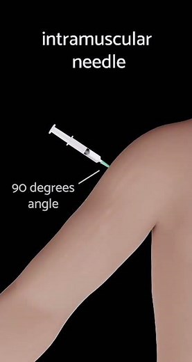Intramuscular Injection: Step-by-Step Explanation | IM Injection Procedure for Beginners