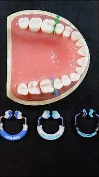 Choosing the right matrix ring matters! Here’s how each Garrison ring is designed differently.