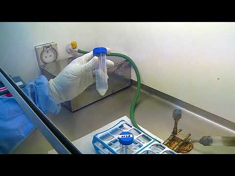 10 Demonstration of processing of sputum specimen for culture for diagnosis of tuberculosis