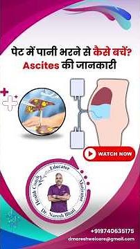 What Which Why It Is Ascites Causes Signs Symptoms Diagnosis Treatment Males Females Gents Ladies