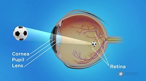 What Is Presbyopia?