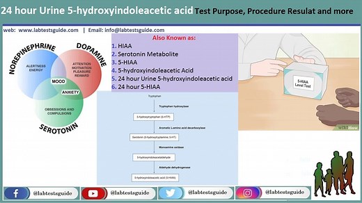 24 Hour Urine 5-Hydroxyindoleacetic Acid Test: Purpose, Procedure, and Results Interpretation | Lab Tests Guide