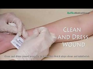 How to Make a Quick Disinfectant for Minor Cuts and Abrasions