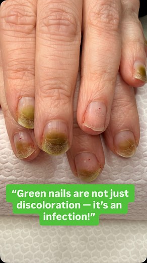 4.1K views · 34 reactions | And here’s the main question… Why do some...