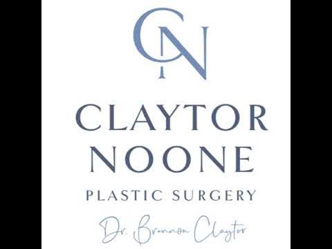 35-Year-Old One Month after Breast Augmentation: "It was a 10/10"