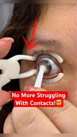 The #1 Tool You Need For SAFE Contact Lens Insertion