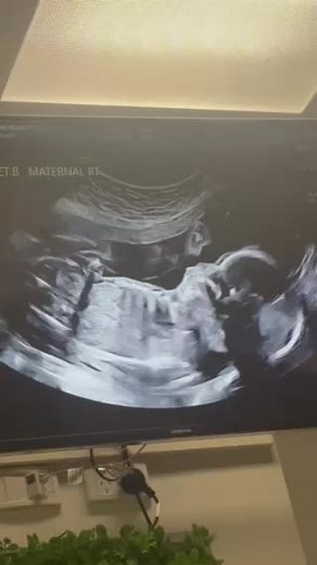 Life With Identical Triplets: A Unique Journey