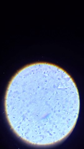Human Sperm under a Microscope