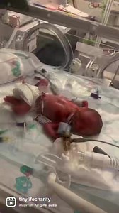 19 reactions | What a year it has been for TinyLife! ✨ Thank you for all the support in 2022. We wish you all a very Happy New Year and can’t wait to see what 2023 has to bring. We are looking forward to continuing our support for babies born too soon, too small and too sick in Northern Ireland.  #TinyLife #TeamTinyLife #goodbye2022 #HappyNewYear | TinyLife | Facebook