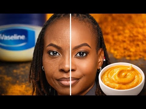 Replaced My Anti-Aging Cream With This DIY… Wrinkles, Dark Spots & Acne Gone 😱