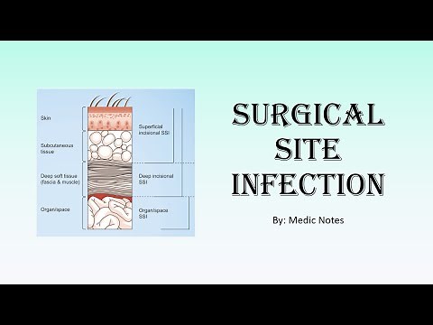 Surgical site infection - classification of SSI, classification of wound, risk factors, prevention