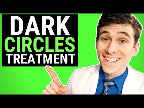 What Are the Different Kinds of Dark Circles Under Your Eyes?
