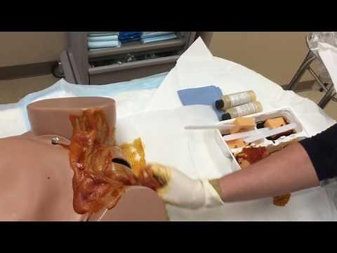 Vaginal Prep (Updated)