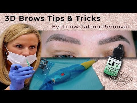 Eyebrow Tattoo Removal using Saline solution