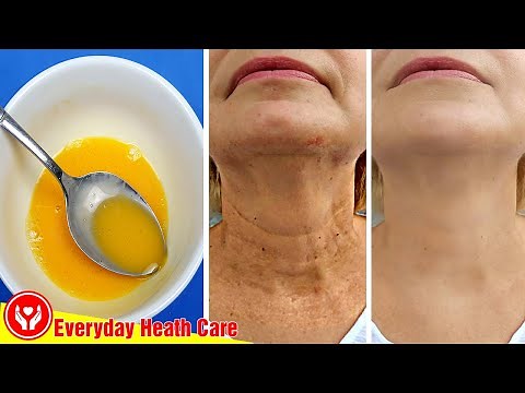 This Mixture Will Remove All Wrinkles Quickly, Use It This Way