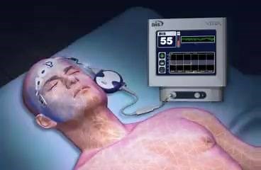 30K views · 532 reactions | The #BIS Bispectral Index Monitor Device for measuring #Depth of #Anesthesia | Anesthesia | Facebook