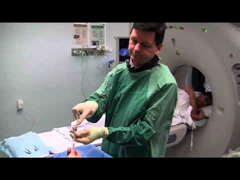 Right Cervical Nerve Root Block