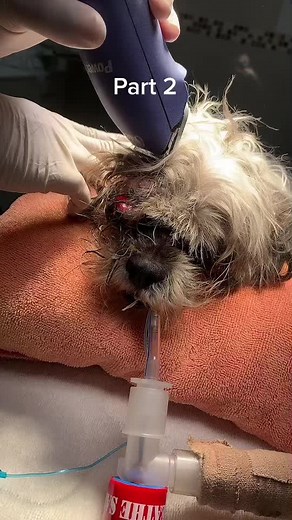 Eye Enucleation Surgery: Complete Guide and Preparation