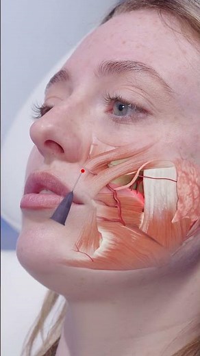 Nasolabial fold anatomy