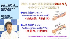 エコーを用いたVascular Access Management運用の実際 - 腎臓内科・透析科 - e-Thoth™医療従事者向け会員制ウェブサイトのご紹介
