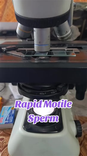 Sperm Cells Under Microscope: A Fascinating Look