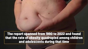 Over 1 Billion People Worldwide Live With Obesity