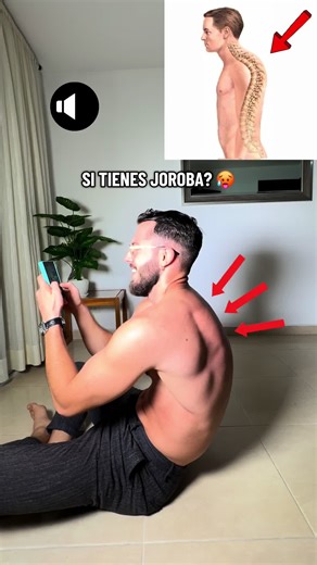 Trabajar la extensión torácica libera intercostales, mejora el movimiento costal y afloja la fascia del esternón y el pectoral. Esa apertura devuelve movilidad al bloque torácico y te permite recuperar un control postural que reduce la tendencia a la joroba. #joroba #chepa #postura #posture #higienepostural