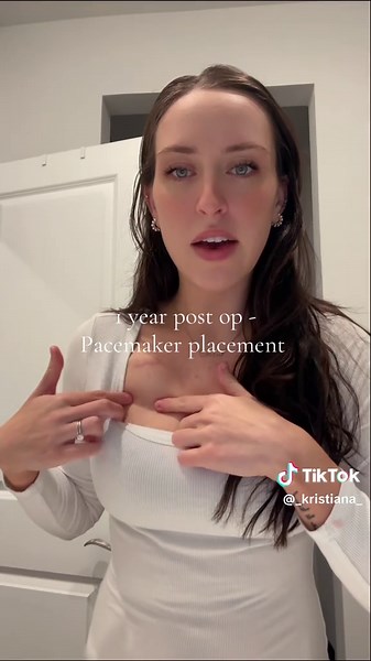 Celebrating One Year Post Pacemaker Surgery