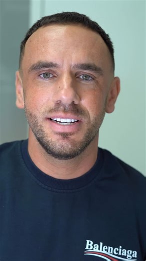 Sefa Arabaci on Instagram: "💎 EMAX WHITE DIAMOND++ 💎 20 stuks Emax Facings WHITE DIAMOND💎 zonder slijpen Als je geen gebroken facings wilt hebben of verkleuring in je facings, dan moet je overstappen van composiet naar emax facings EMAX FACINGS De facings van Crystalign verkleuren niet. Emax is een hard en sterk materiaal dat veel duurzamer is dan composiet en porselein. Het biedt een esthetisch zeer mooie uitstraling. Verkrijgbaar in alle tandkleuren – inclusief de witste tinten die hun kleu