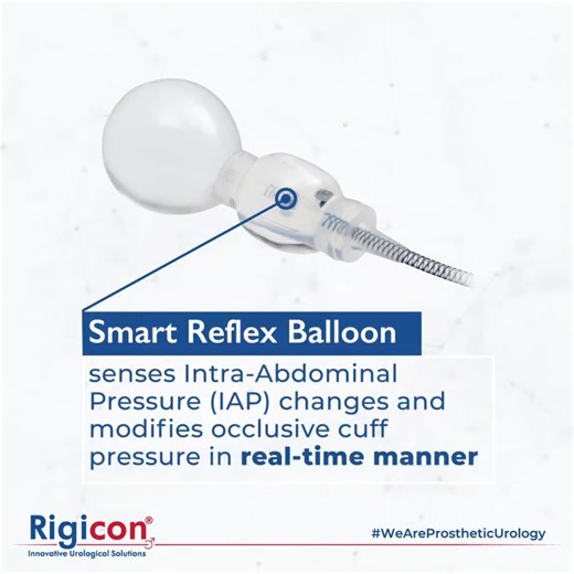 Rigicon has brought numerous innovations to the field of prosthetic urology, including redefining the new gold standard to treat urinary incontinence with ContiReflex Enhanced Artificial Urinary Sphincter. ContiReflex Enhanced Artificial Urinary Sphincter‘s Smart Reflex Balloon (an innovative technology revolutionizing the field of AUS) senses intra-abdominal pressure (IAP) changes and, modifies occlusive cuff pressure in real-time manner. An innovation combined with a simple and robust design. 