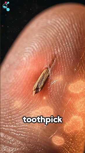 Don’t Ignore That Splinter