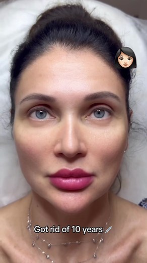 Full Face Injections at Touche Clinic