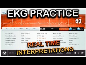 EKG Real Time Practice Interpretations! (EMS)