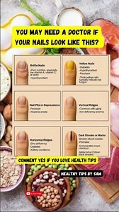 Brittle Nails? Yellow Nails? Dark Lines? What They REALLY Mean!