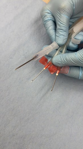 Needle Sizes for Blood Donation: Understanding the Gauge